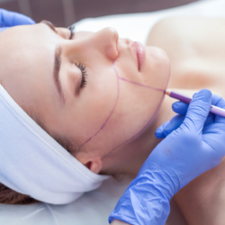 Know About the Face Sculpting and V line Face Lift