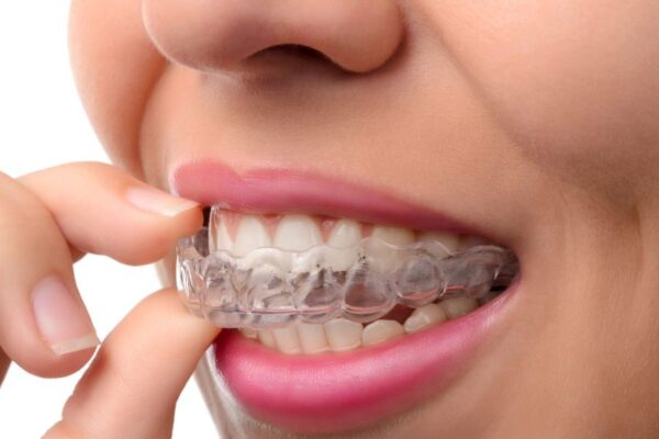 Preventing Crooked Teeth- Effective Tips From Dentists!