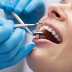 Why should I go for dental restoration methods? Know the right time here!