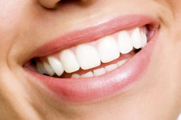 Should I See a Dentist Before Getting My Teeth Whitened?