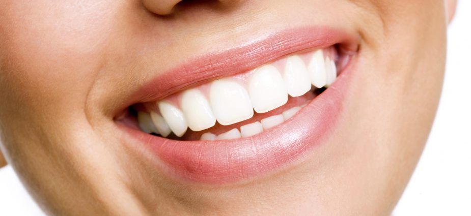 Should I See a Dentist Before Getting My Teeth Whitened?