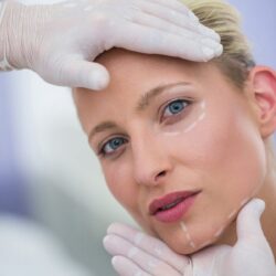 Face Lift
