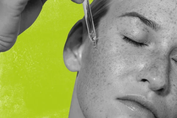 Features of an Anti-Acne Face Serum: What Makes It Effective?